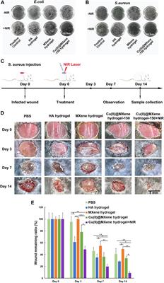 Cu(II)@MXene based photothermal hydrogel with antioxidative and antibacterial properties for the <mark class="highlighted">infected wounds</mark>